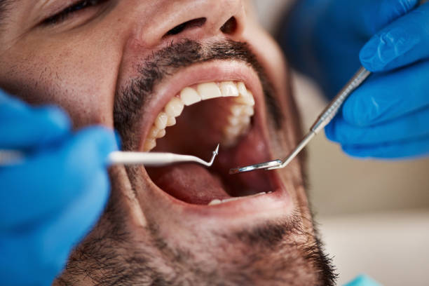Best Broken Tooth Emergency  in Lake Mathews, CA